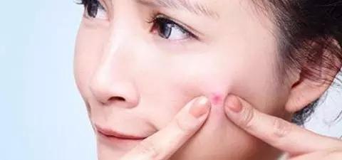 痘痘交流群:脸上的青春痘一直下不去，有什么办法彻底根治青春痘？
