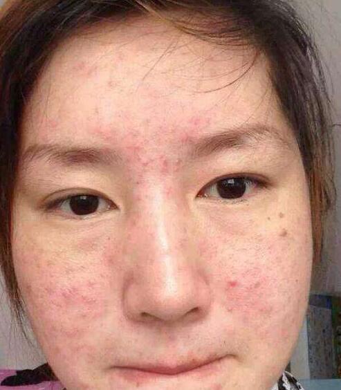 头条问答 - 睡眠质量不好是直接导致皮肤粗糙,暗沉的直接原因吗?