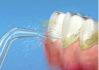 牙间刷(牙间刷和牙线的区别)