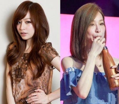 杨幂整容失败:54岁千百惠脸僵似塑胶人，还有哪些整容失败的明星？