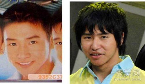 罗霈颖整容对比照:在韩国整容是不是很普遍的事情？