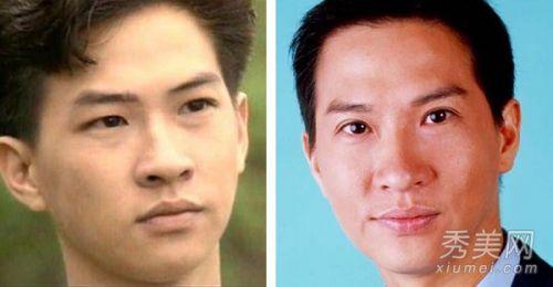 罗霈颖整容对比照:在韩国整容是不是很普遍的事情？