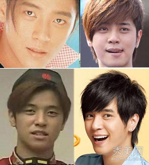 罗霈颖整容对比照:在韩国整容是不是很普遍的事情？
