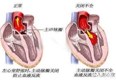 55健康网 疾病百科:血压高压120低压55正常吗？ 39健康网疾病查询