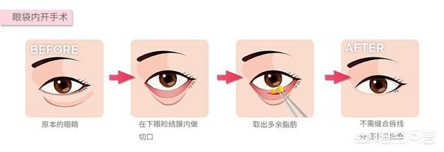 田永成隆鼻:皮肤长斑与肌肤缺水有关吗