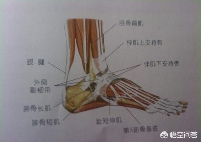 胫腓骨骨折对位对线不佳:胫腓骨双骨折内固定手术三个月了居然还没长好，什么问题？