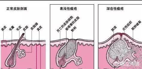 医肤基(医肤基产品怎么样)