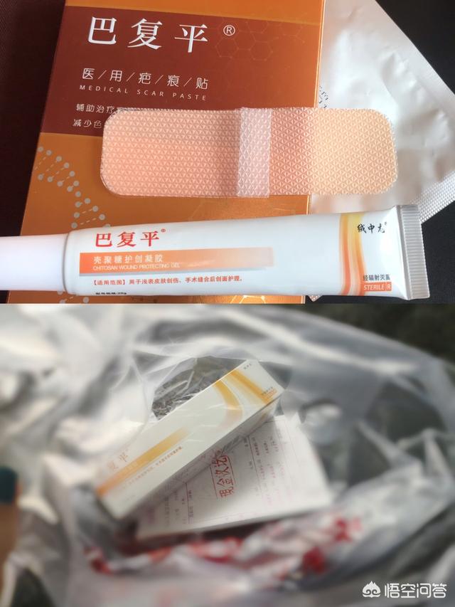 怎么样可以把脸上的疤痕去掉