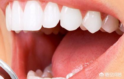 想要美白牙齿,用什么样的电动牙刷会有效果？