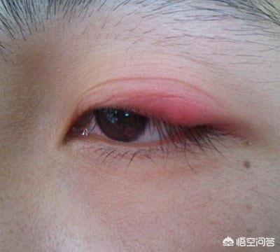 古巨基割双眼皮:为什么女的要整形成双眼皮