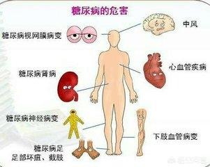 无痛性跛行:无痛性跛行是什么引起的 高血压、脑梗死、心衰，是糖尿病并发症吗？