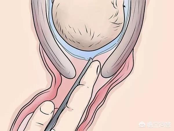 催产针注射须知有哪些，孕妇在什么情况下需要打催产针，打了催产针会对胎儿有哪些影响