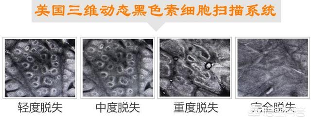 阳性阴性什么意思:医学检查中为什么叫阴性和阳性？