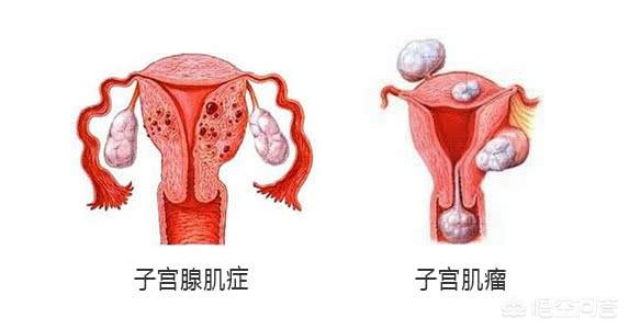 绝经什么时候最好?