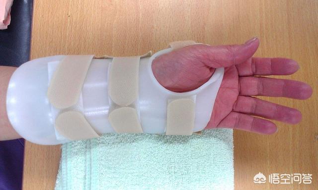 在传统的中医伤骨科整复中,多采用保守治疗,手法整形后打石膏固定五个