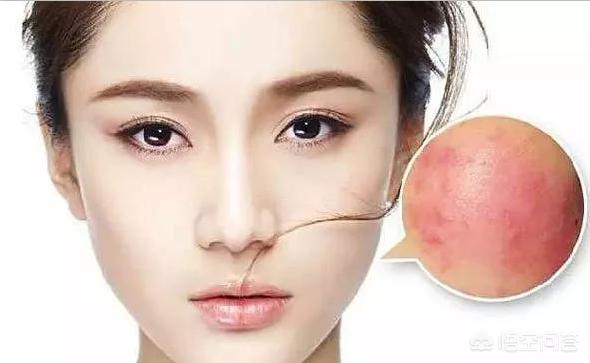 硫磺香皂洗脸:硫磺香皂洗脸多久洗一次 女生用硫磺皂来洗脸好吗？这么做是不是容易堵塞毛孔呢？