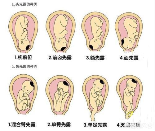 胎儿一般什么时候入盆入盆后孕妇有什么不同