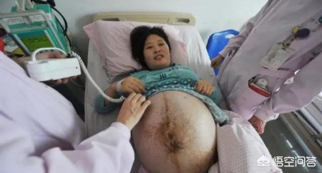 男子活剖孕狗拍视频无删减:大狗死了怀孕52天的小狗剖腹产能活吗？