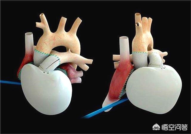 目前医学上人体都有哪些部位可以安装人工器官?-育儿网