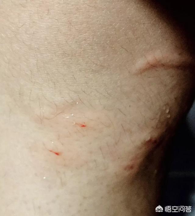 柯南 踩到猫了:不小心把猫咪的尾巴踩了，猫咪会怎么想？