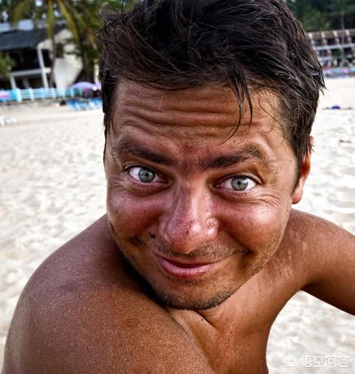 头条问答 - 男士学车晒黑后如何快速变白?(4个回答)