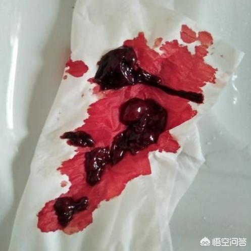 造成女性死胎的原因:孕妇前期胎亡是什么原因？