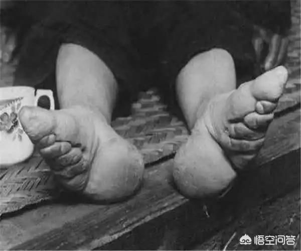 裹脚布:古代为什么要裹脚，意义在哪？