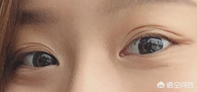 古巨基割双眼皮:为什么女的要整形成双眼皮