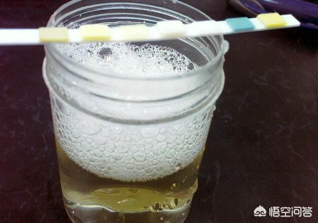 常规检查发现有蛋白尿1十这是怎么回事该怎么治疗