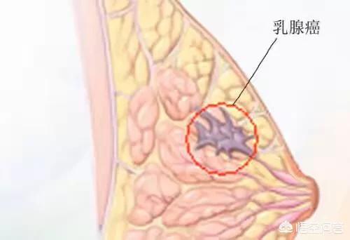 遗传病有哪些:有哪些遗传病会受到性别的影响？