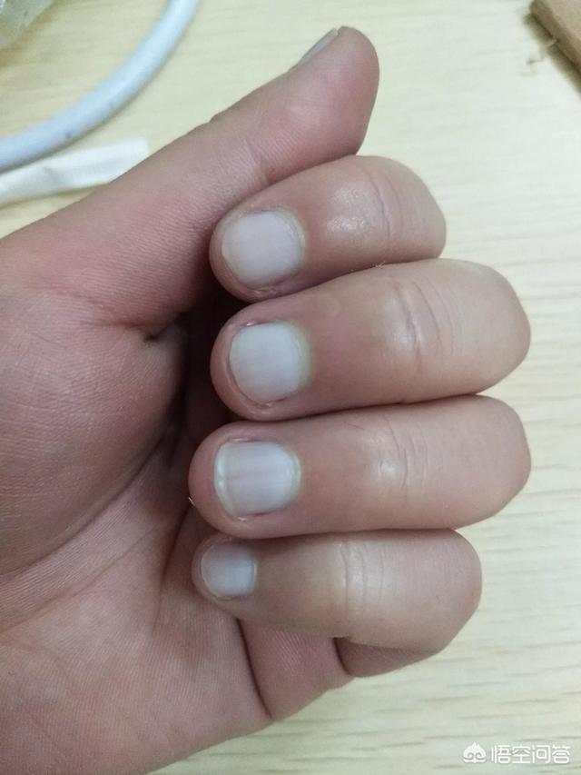 头条问答 - 指甲变白了是什么原因?(21个回答)