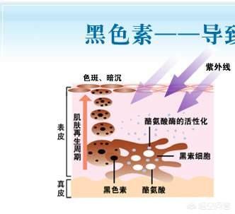 怎样才能嫁预防白癣风:夏季白癜风为何频发？白癜风病人该如何度过炎热的夏天？