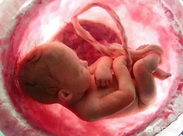 怀孕时候缺氧是种什么状态，胎儿宫内缺氧孕妇有什么症状
