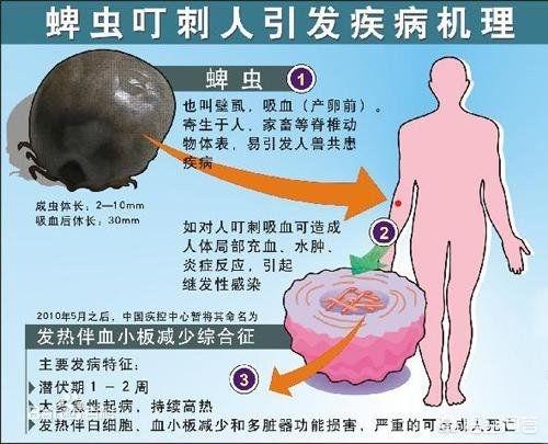 蜱虫图片:家里的狗狗让蜱虫咬了，应该怎么办？