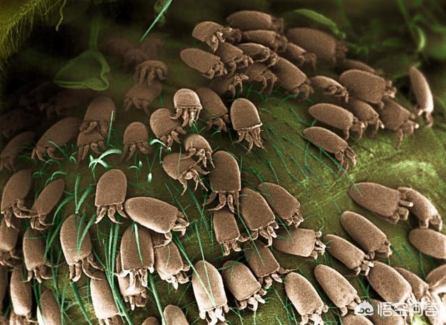 如何知道自己头皮有没有螨虫，头皮屑超多，是螨虫造成的吗？为什么会长螨虫？