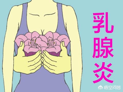 哺乳时乳腺炎的症状是什么:哺乳期时胸特别烫，是不是得乳腺炎了呢？
