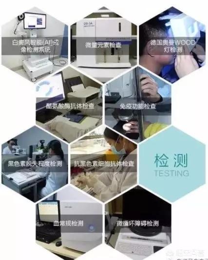伍德氏灯检查淡白色:汗斑与白癜风在伍德灯下好区分吗？