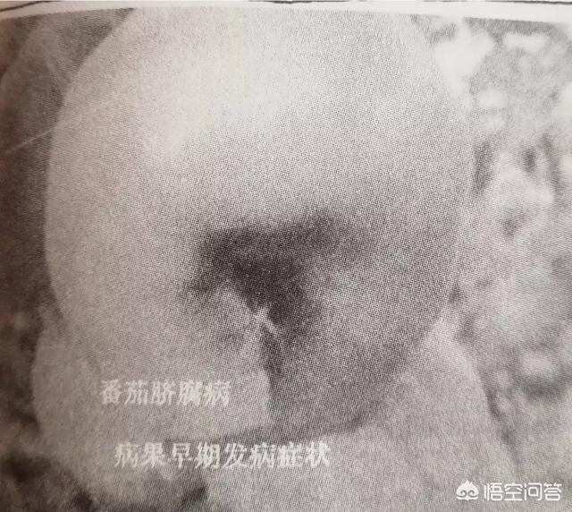 得莱姆病症状:梅尼埃症的症状是怎样的？ 莱姆病的症状