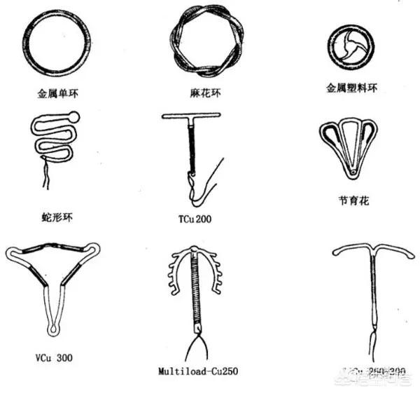 节育环的形状有几种图片