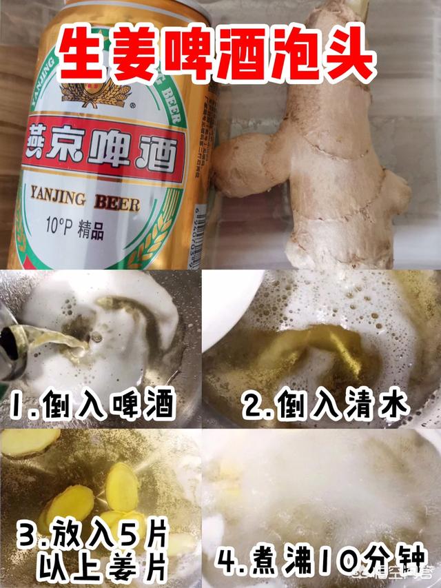 脱毛症:十个脱发八个螨，头螨是脱发的原因吗？
