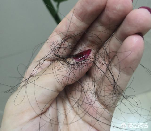 螨虫叮咬症状:宝宝身上被螨虫咬的好多痘痘，该怎么办？