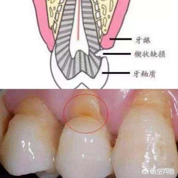 口腔上方内壁疼痛可以喝水，口腔左上方内壁疼痛