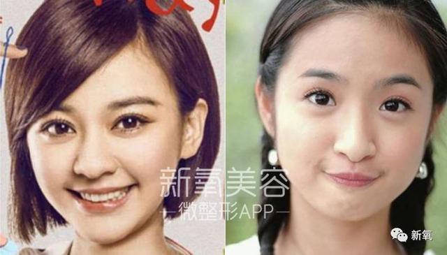 孙佳仁朱智勋:双眼皮一定比单眼皮美么？有哪些单眼皮却很美的明星？