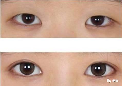 孙佳仁朱智勋:双眼皮一定比单眼皮美么？有哪些单眼皮却很美的明星？