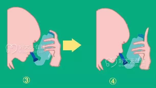 洗鼻盐水,盐水洗鼻是怎么回事，怎么操作？