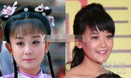 邵音音整容:有哪些整容失败的女明星？
