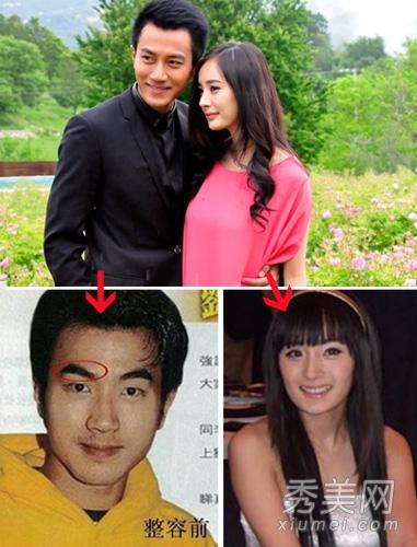 罗霈颖整容对比照:在韩国整容是不是很普遍的事情？