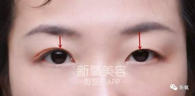 孙佳仁朱智勋:双眼皮一定比单眼皮美么？有哪些单眼皮却很美的明星？