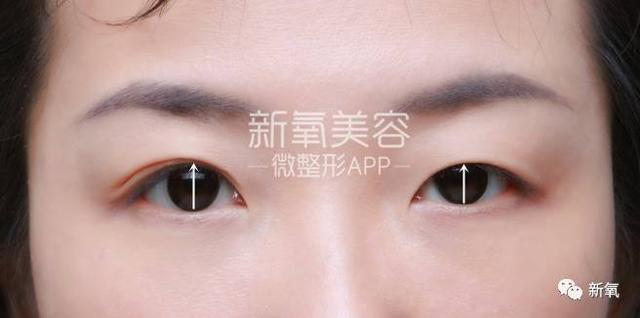 孙佳仁朱智勋:双眼皮一定比单眼皮美么？有哪些单眼皮却很美的明星？
