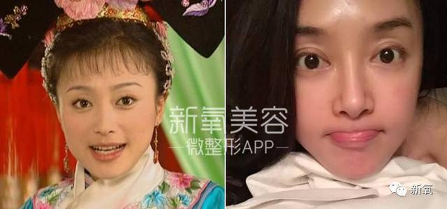 孙佳仁朱智勋:双眼皮一定比单眼皮美么？有哪些单眼皮却很美的明星？